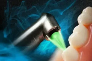 Laser Dentistry